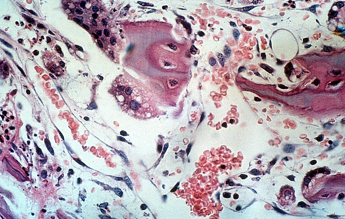 Osteoclasts, LM