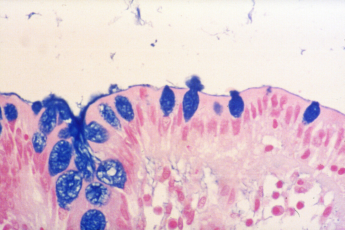 Mucin, Goblet Cells, LM