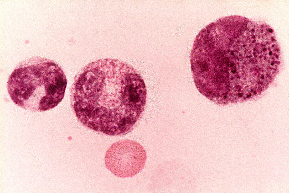 Myelocyte, Basophil, LM