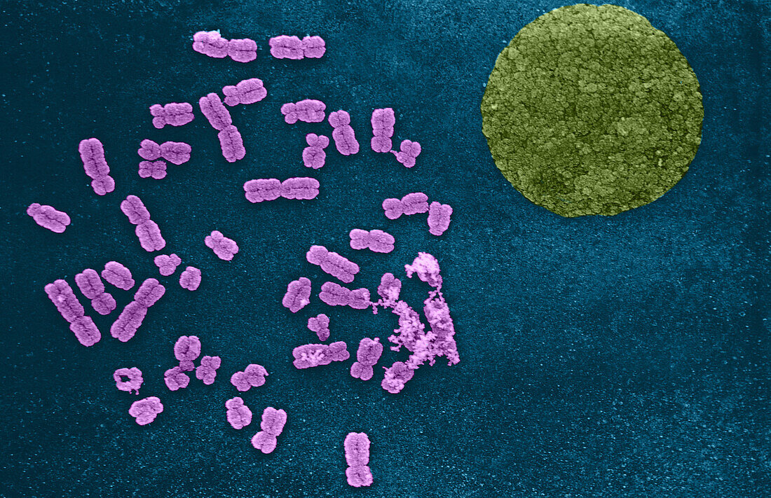 Chromosomes and Nucleus