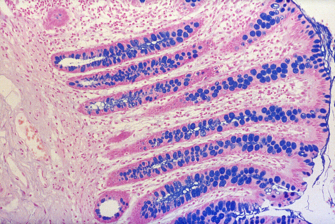 Large Intestine, Goblet Cells, LM