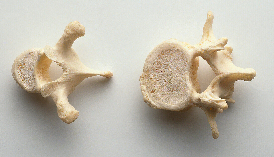Thoracic and lumbar vertebrae