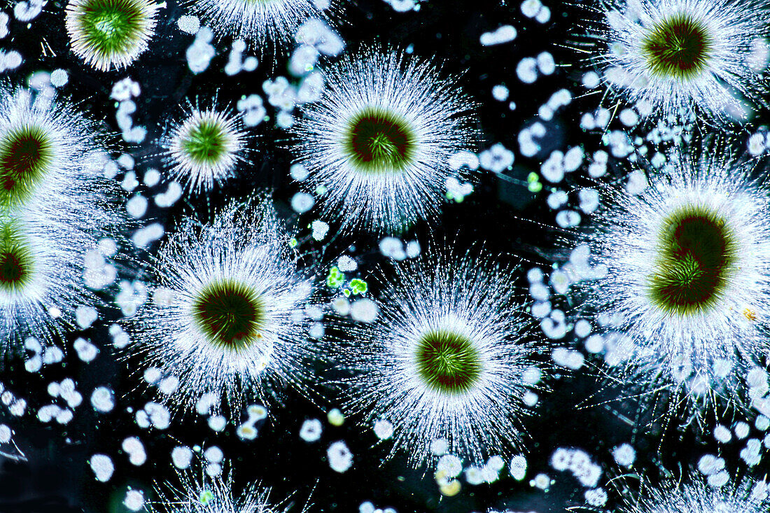 Gloeotrichia echinulata, light micrograph