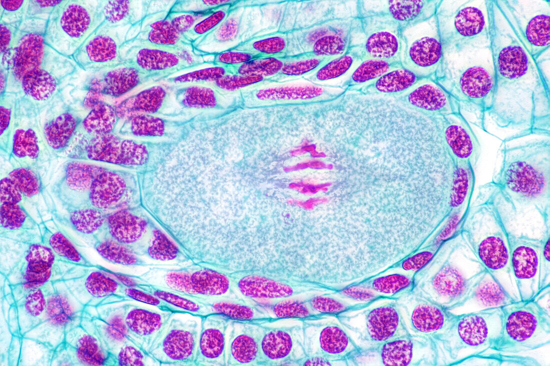 First division of a Lilium embryo sac, light micrograph