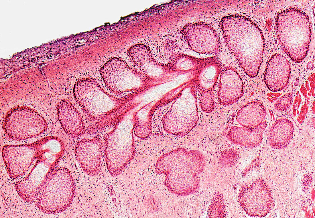 Meibonian (tear) gland, light micrograph