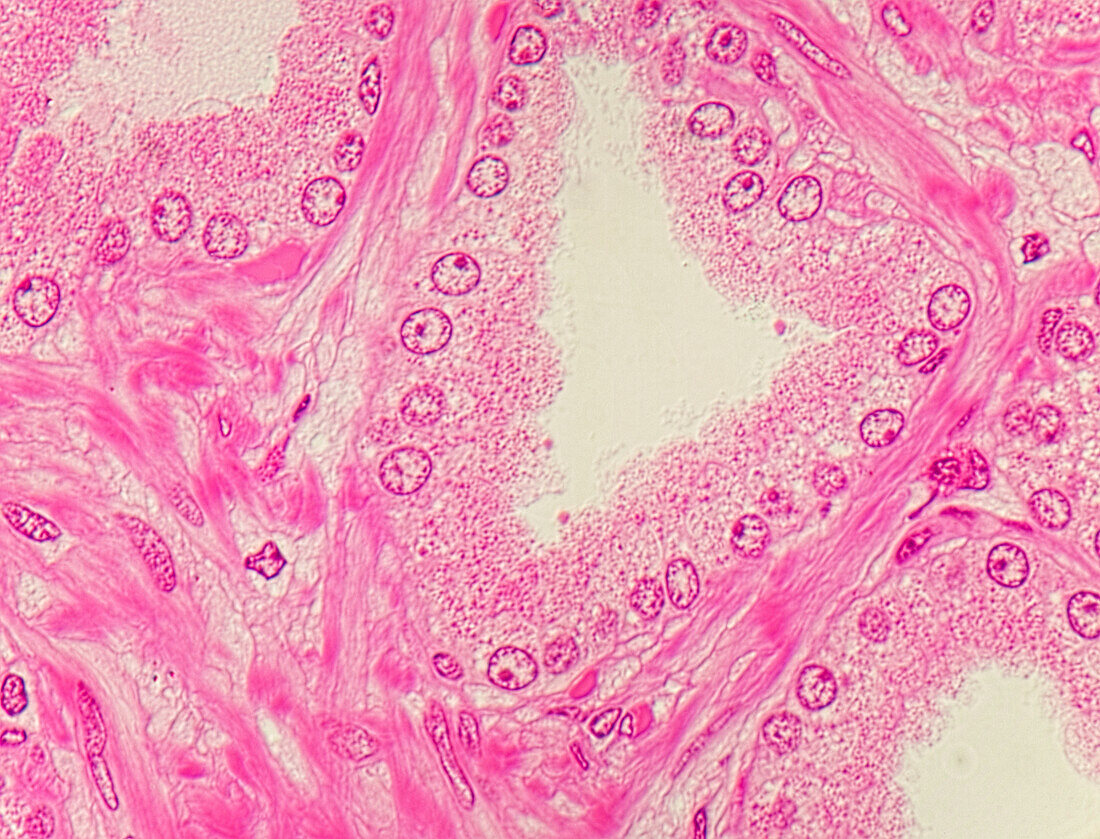 Prostate gland, light micrograph