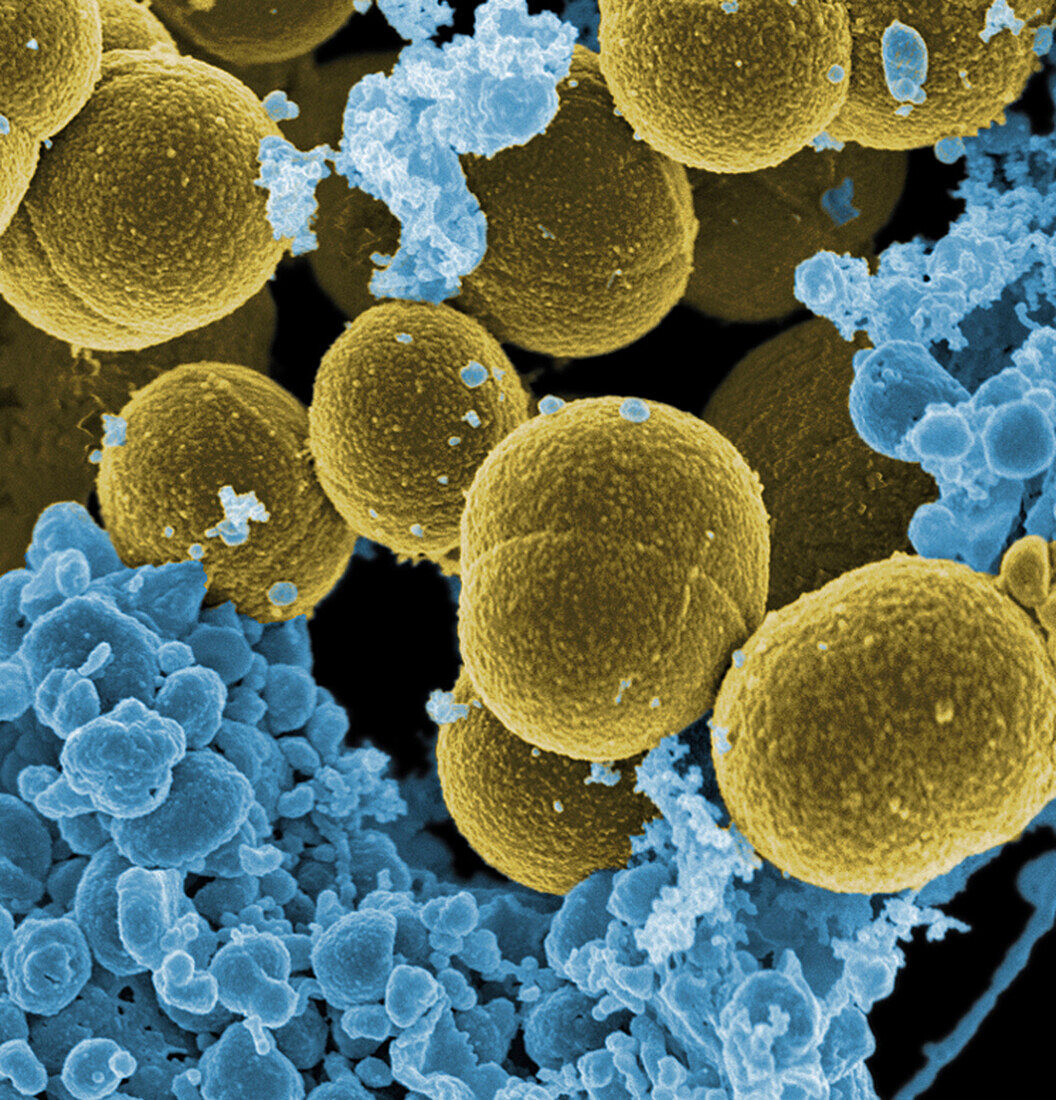 Staphylococcus aureus and white blood cells, SEM
