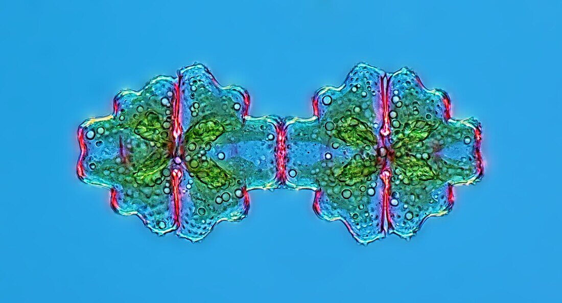 Euastrum desmid cell division, light micrograph