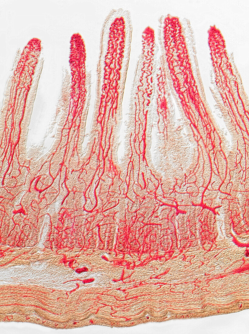 Villi, injected, light micrograph
