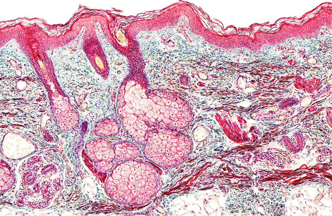 Sweat and sebaceous glands, light micrograph