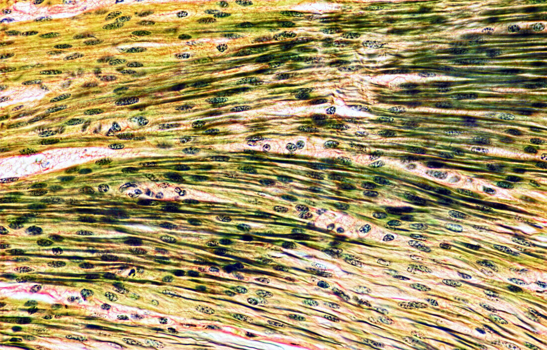 Smooth muscle, light micrograph