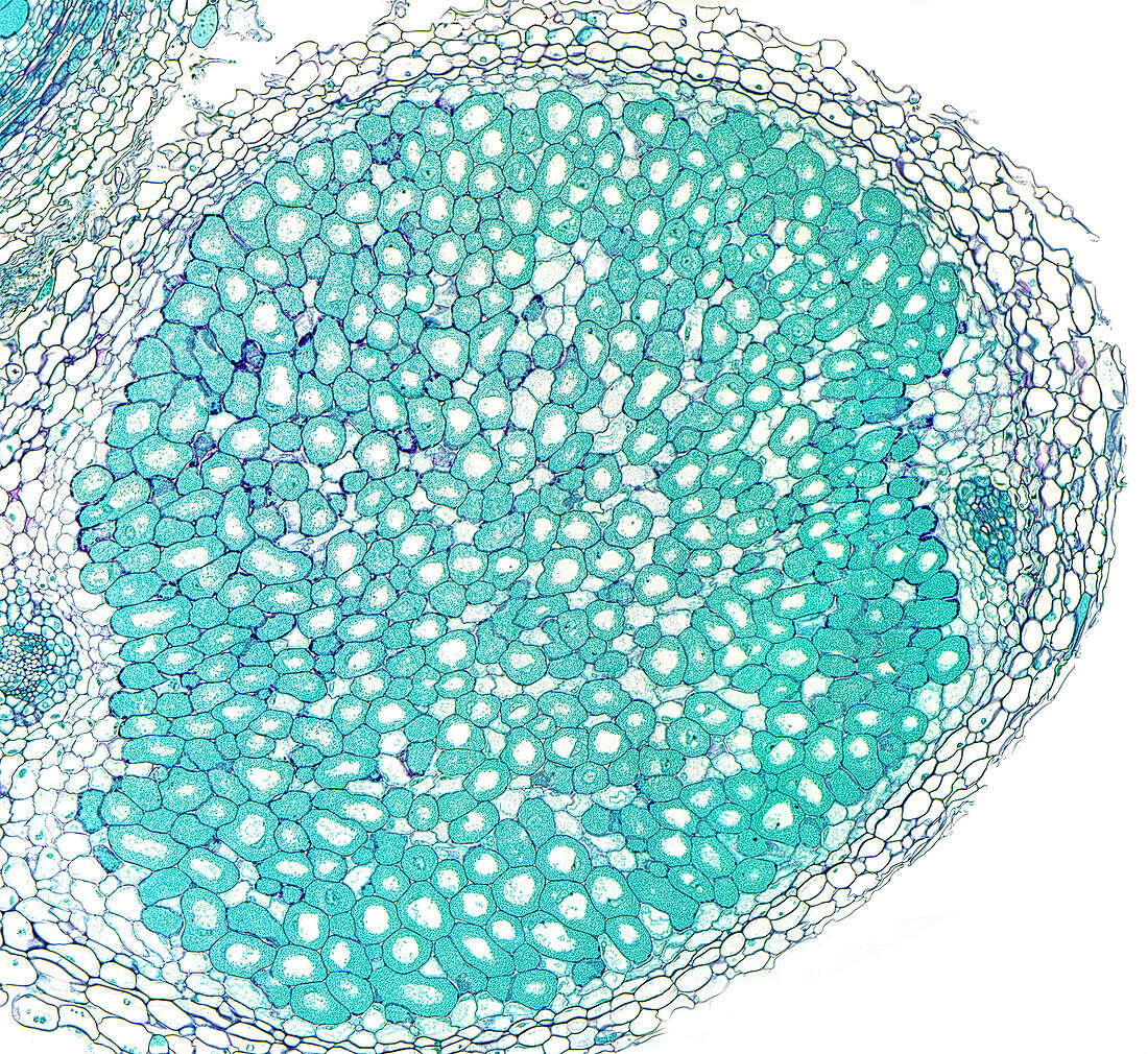 Rhizobium sp. legume root nodules, light micrograph