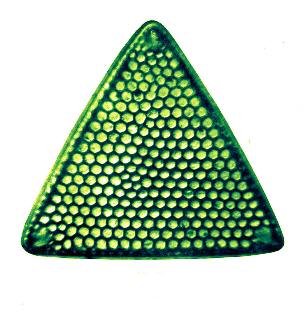 Triceratium favus diatom, early photomicrograph