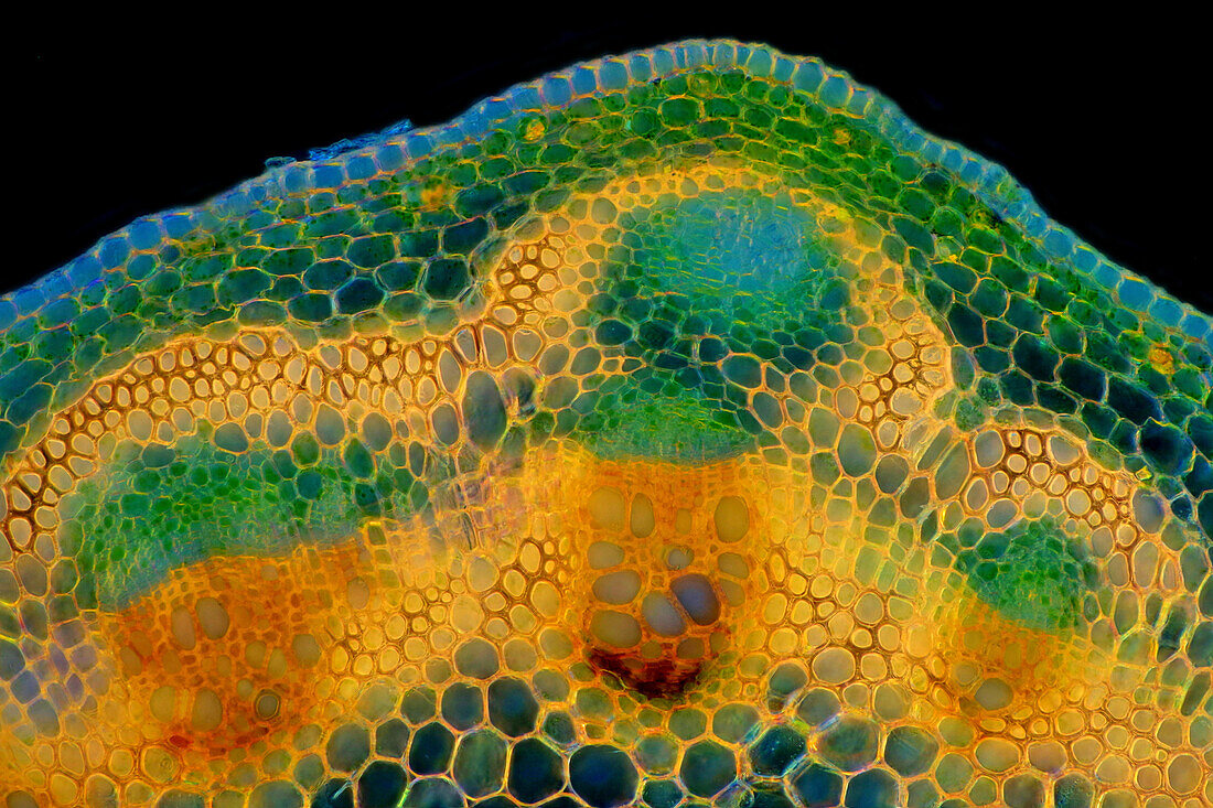 Spring pea stalk, light micrograph