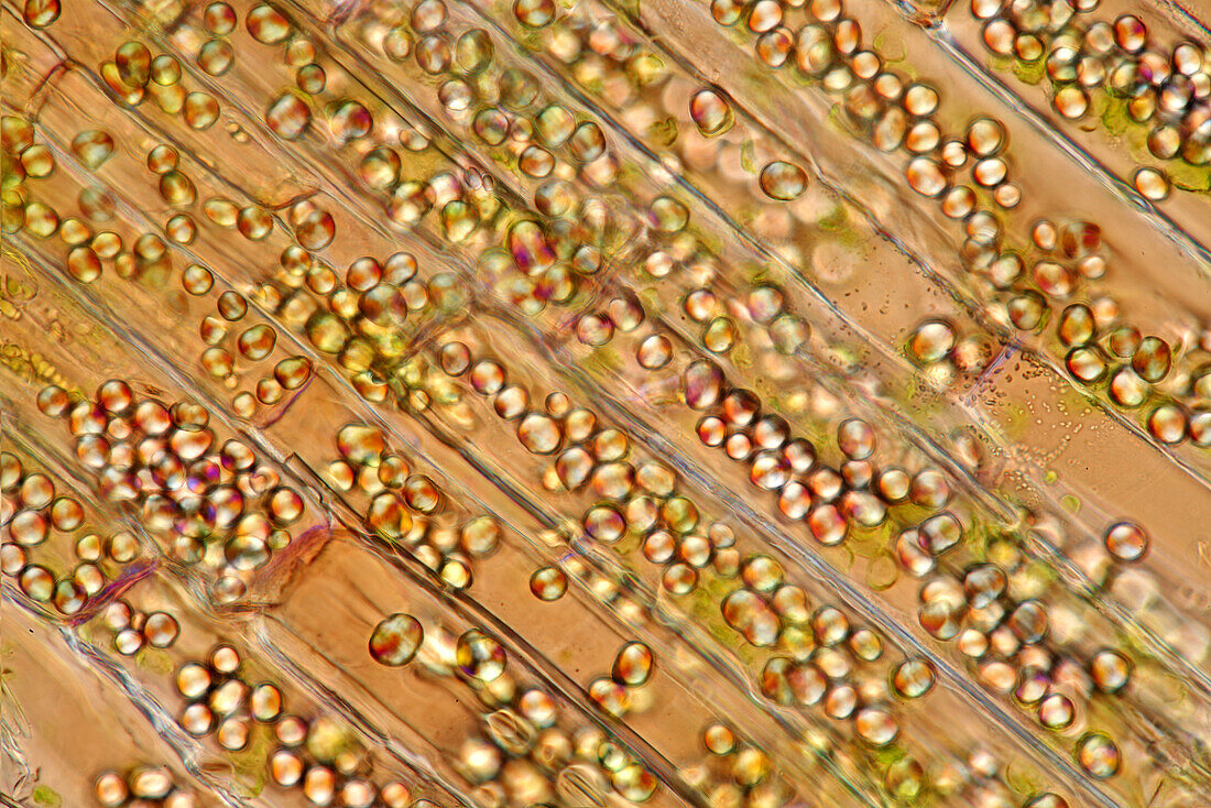 Starch grains in Canadian pondweed stalk, light micrograph