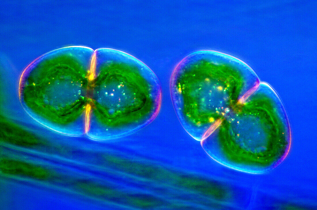 Desmids on Sphagnum moss, polarized light micrograph