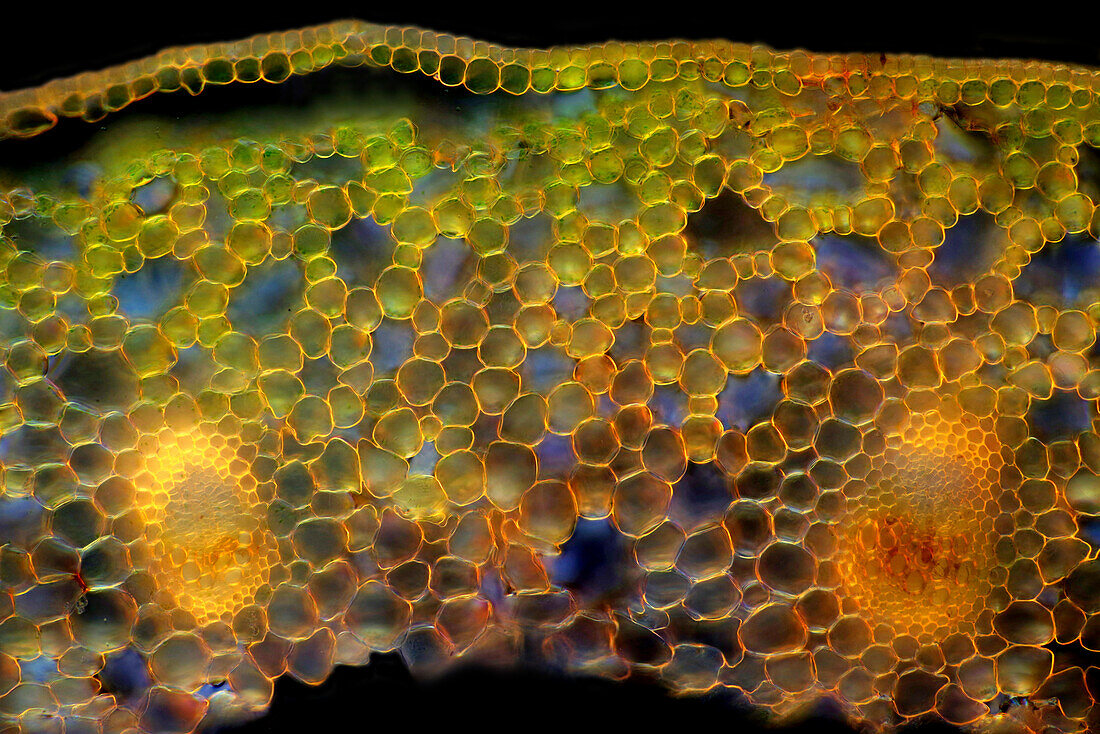 Marsh marigold stalk, light micrograph