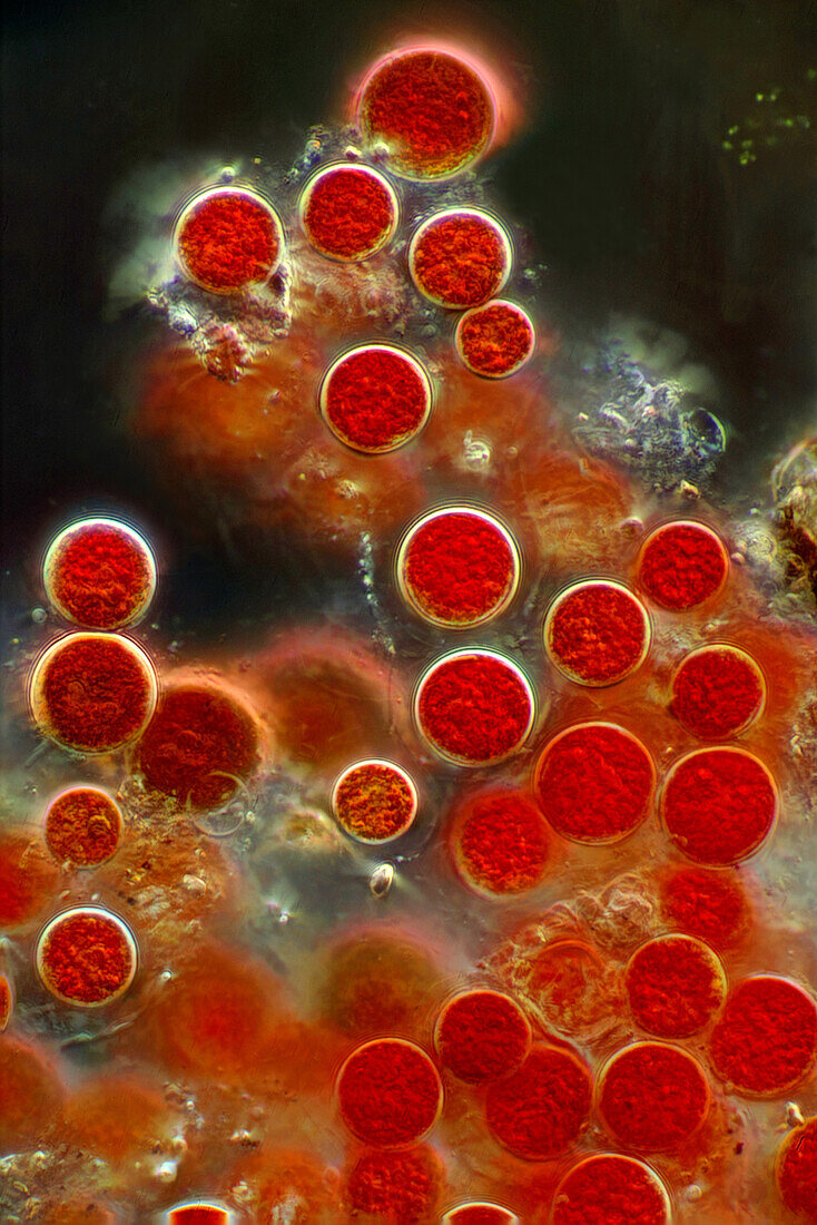 Haematococcus pluvialis, light micrograph