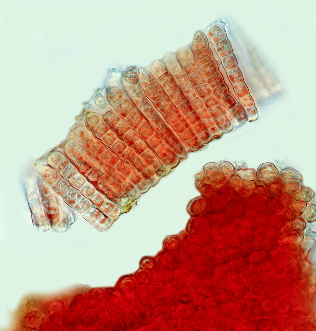 Hildenbrandia sp. freshwater red algae, light micrograph