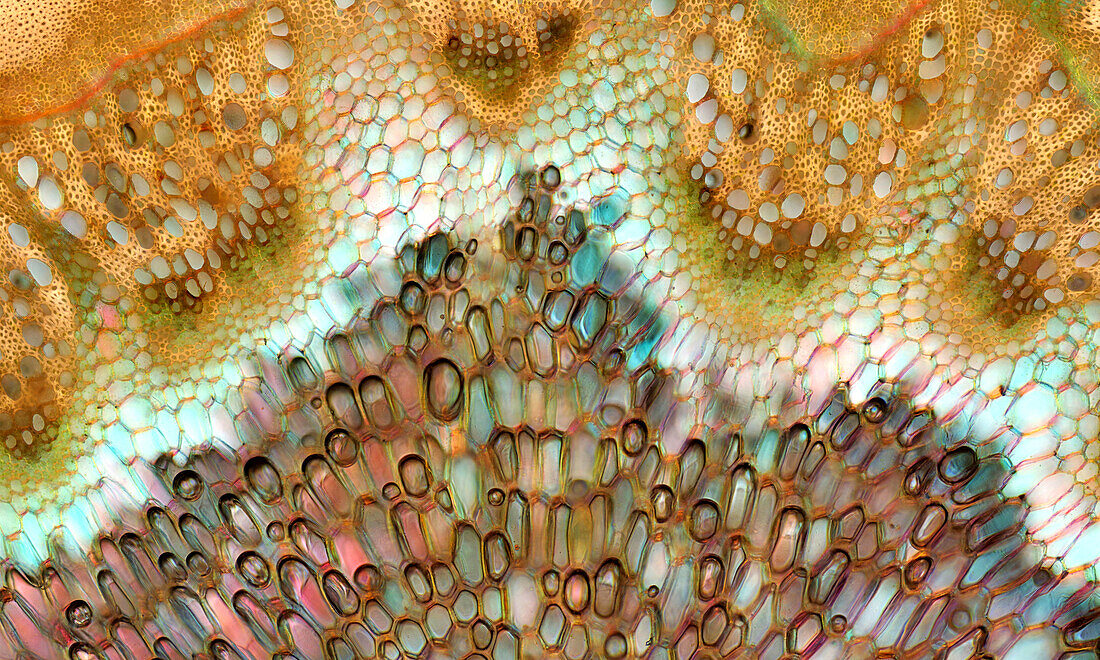 Chenopodium sp. cells with air bubbles, light micrograph