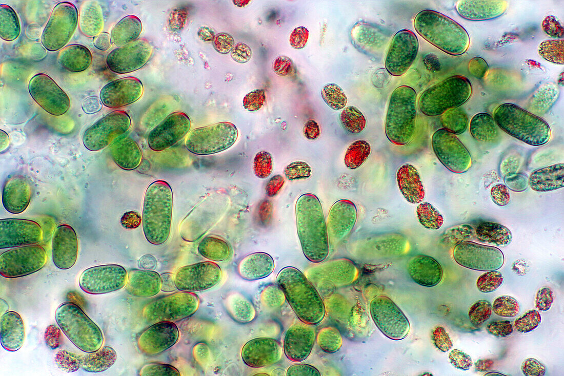Cyanobacteria, polarised light micrograph