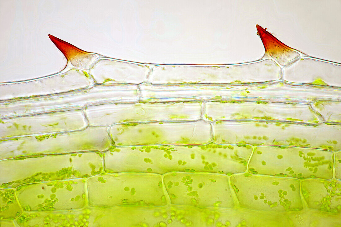 Diatoms on surface of Canadian pondweed, light micrograph