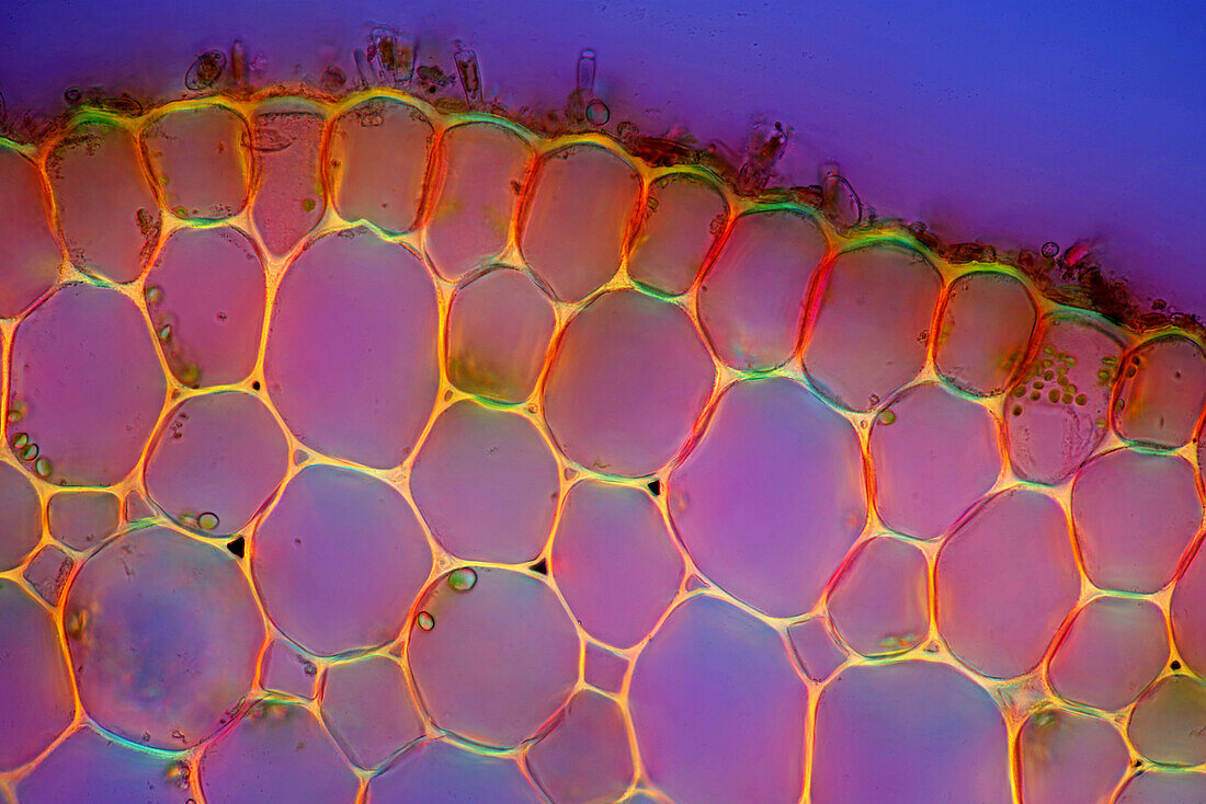 Elodea canadensis stalk, polarised light micrograph