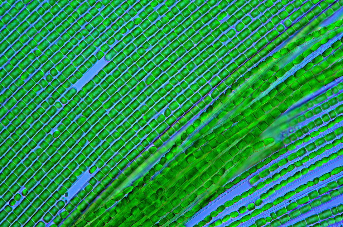 Filamentous green algae, polarised light micrograph