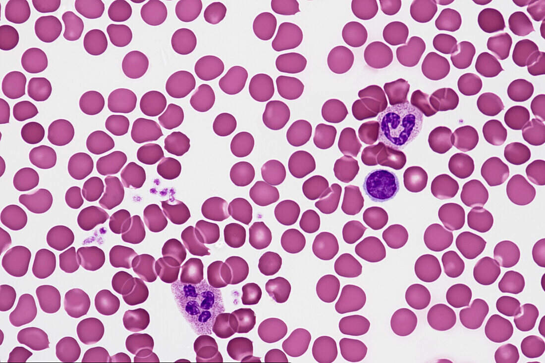 Blood smear, light micrograph