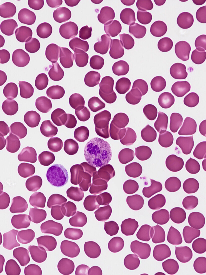 Blood smear, light micrograph