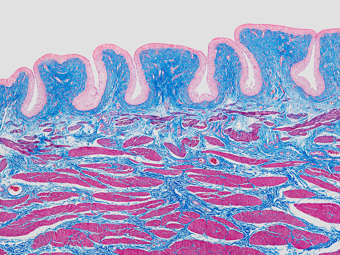 Urinary bladder wall, light micrograph
