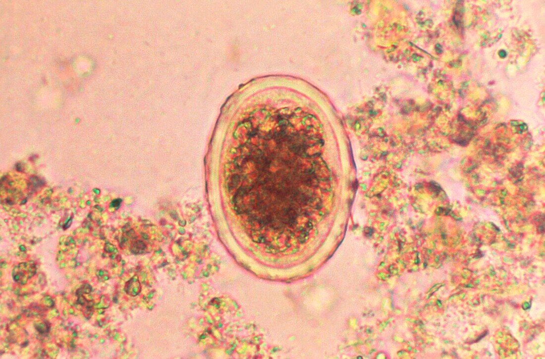 Ascaris lumbricoides egg, light micrograph