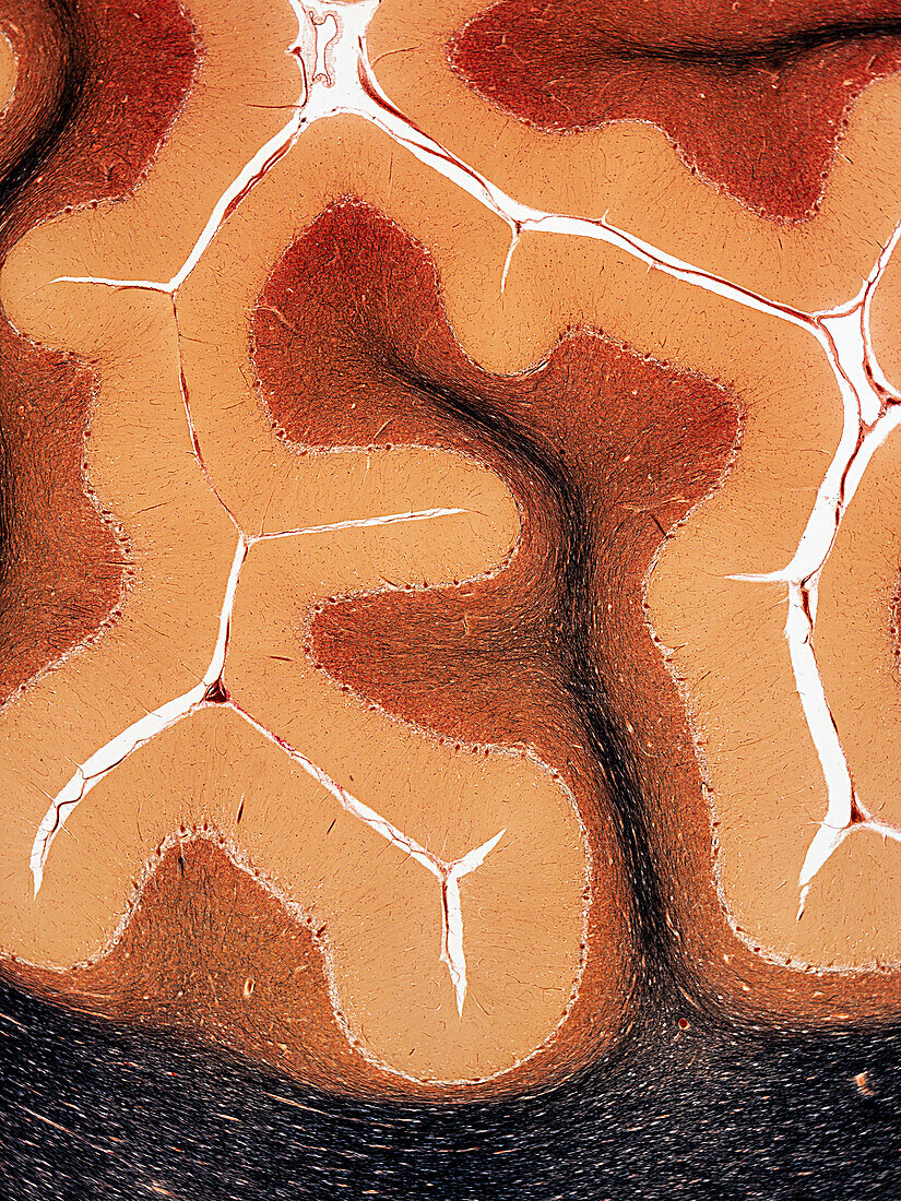Cerebellum tissue, light micrograph
