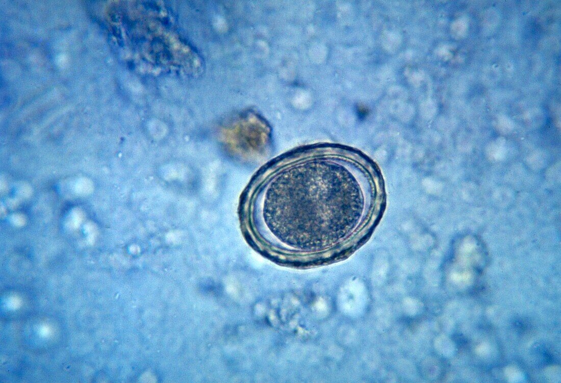Fertilized Ascaris lumbricoides egg, light micrograph