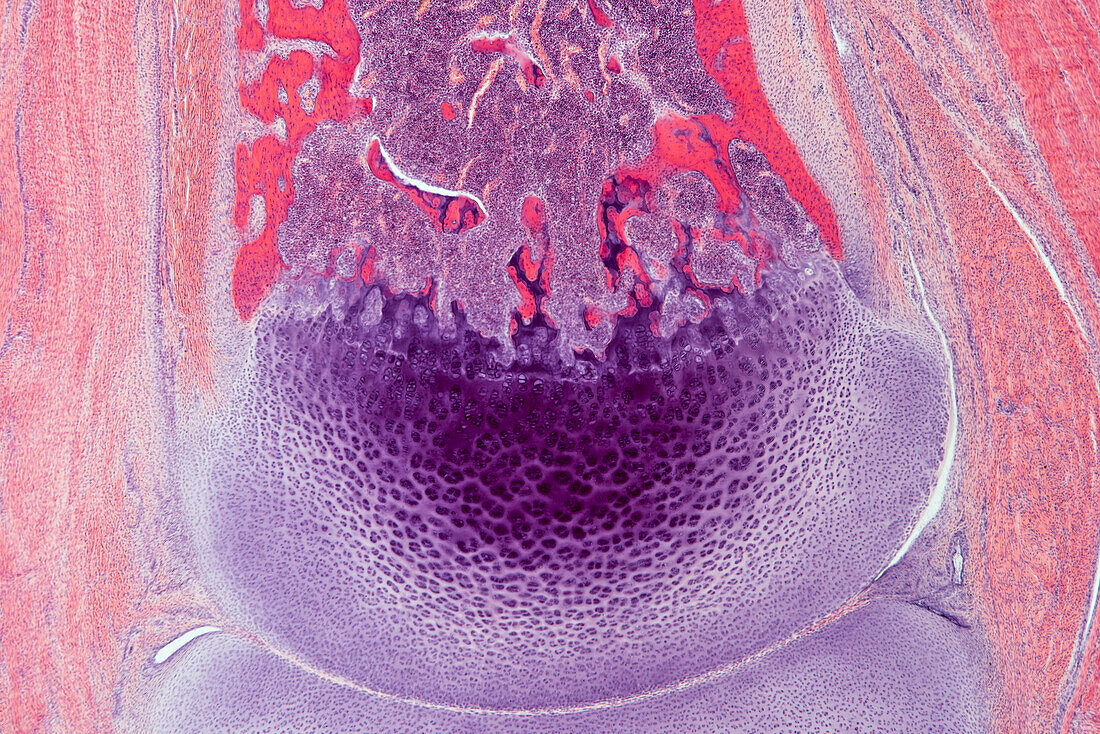 Foetal finger joint, light micrograph