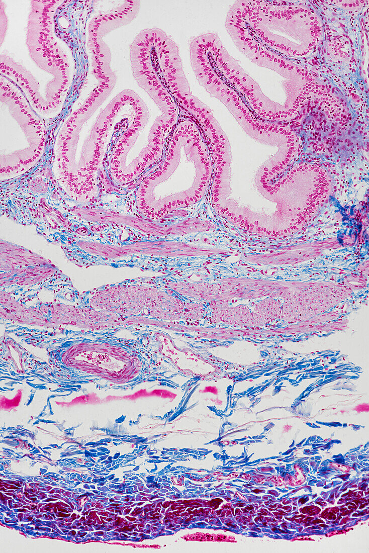 Gallbladder, light micrograph