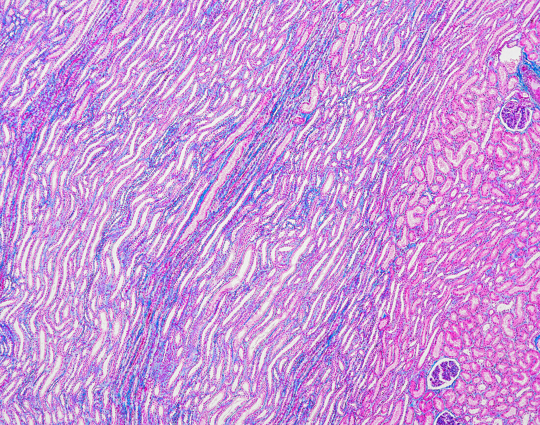 Kidney, light micrograph