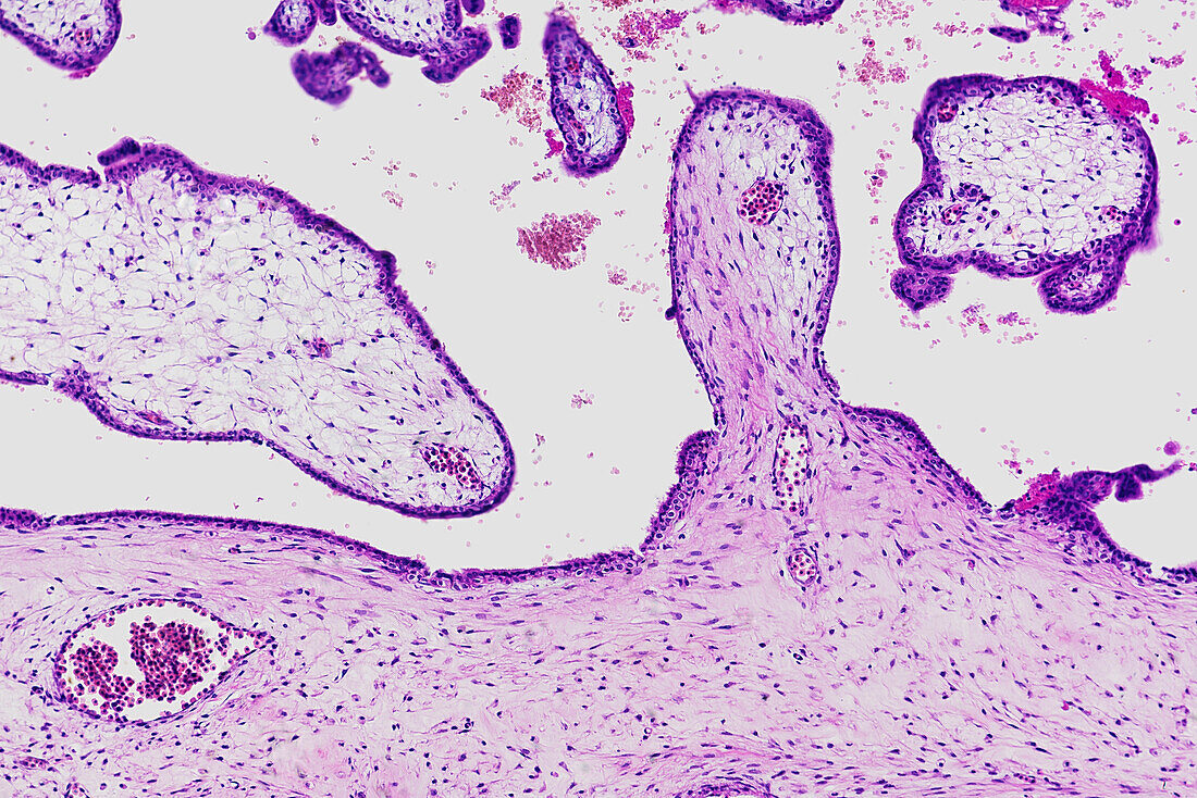 Placenta, light micrograph