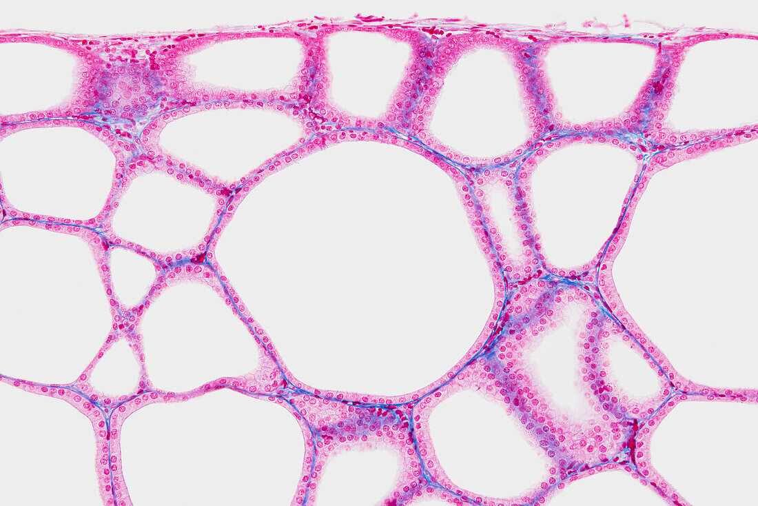 Thyroid follicles, light micrograph