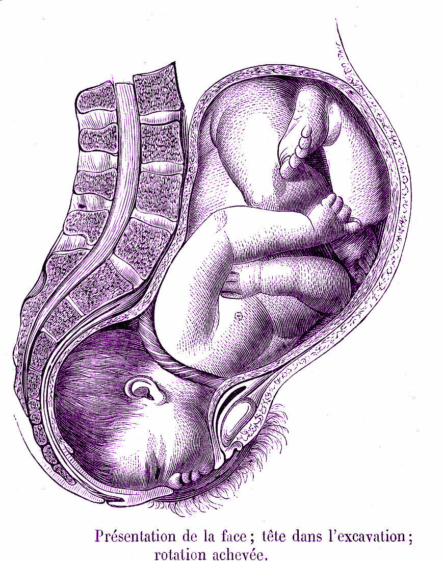 Foetal childbirth position, illustration