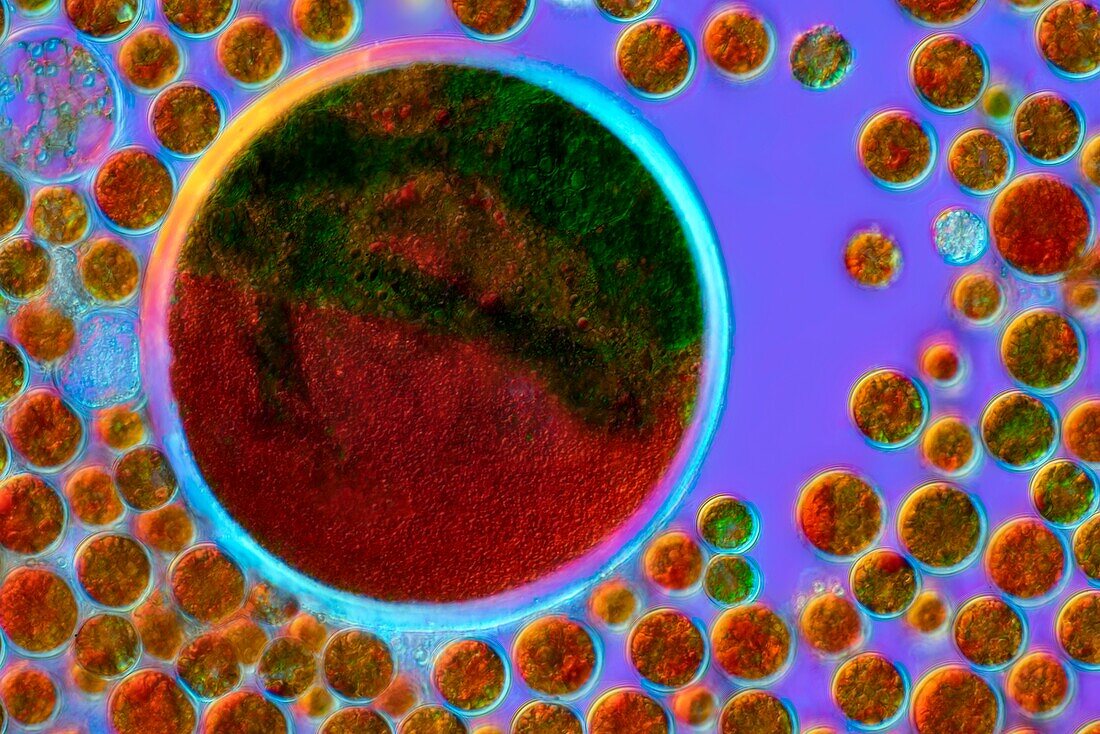 Haematococcus sp. green algae, light micrograph