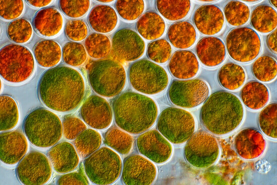 Haematococcus sp. green algae, light micrograph