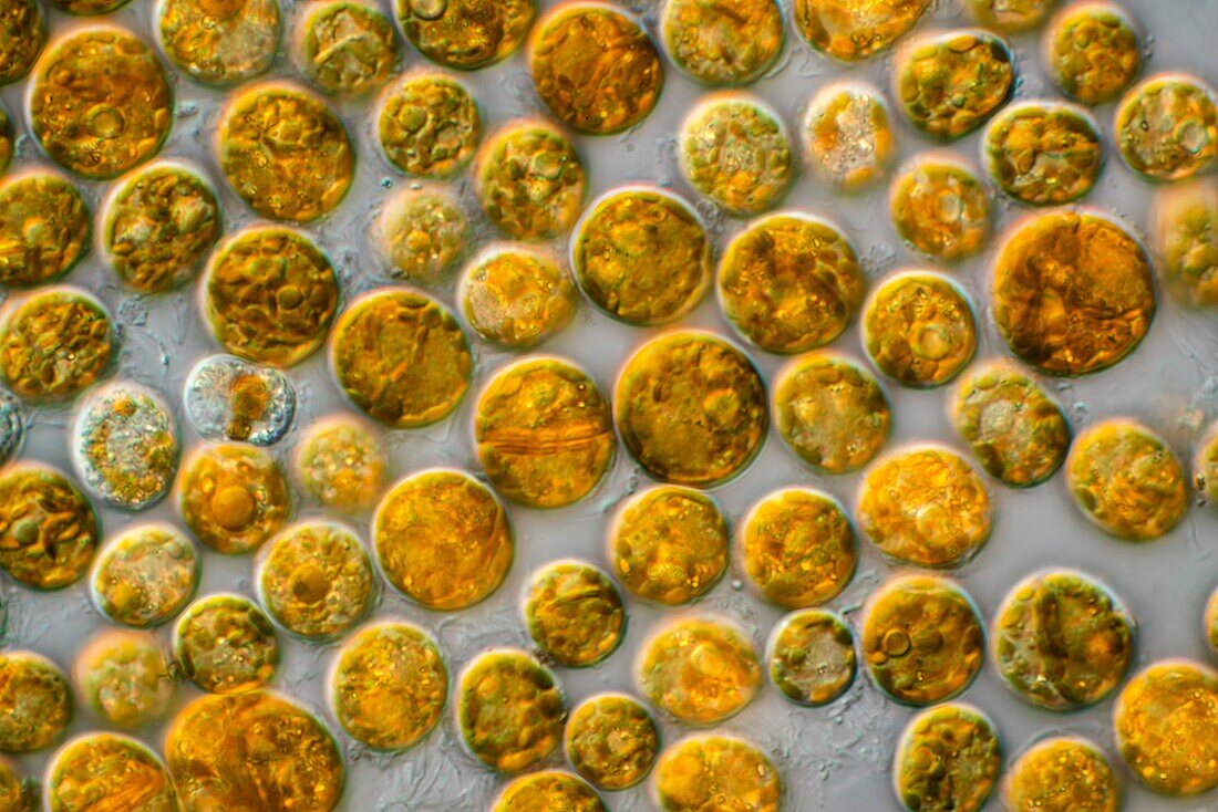 Symbiodinium sp. green algae, light micrograph