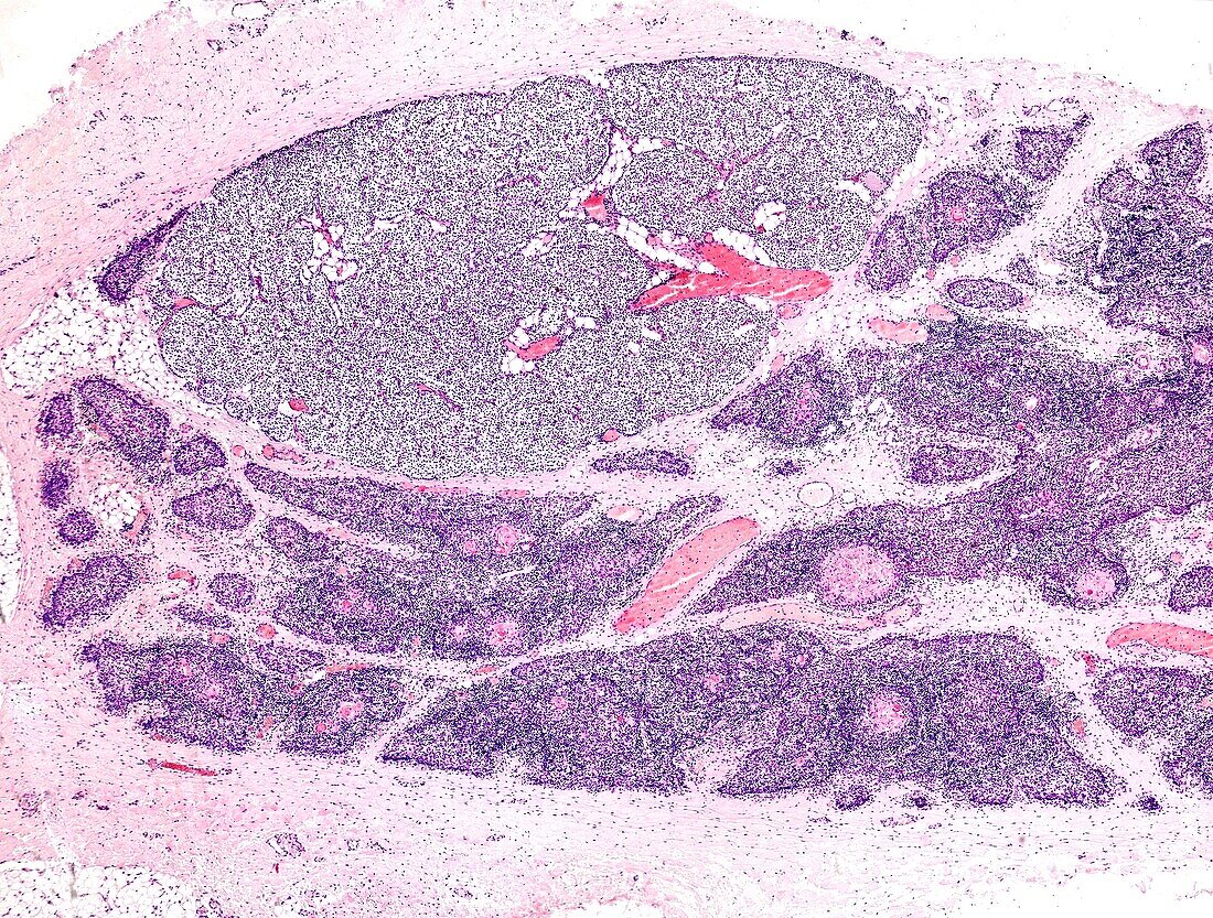 Parathyroid gland of a child, light micrograph