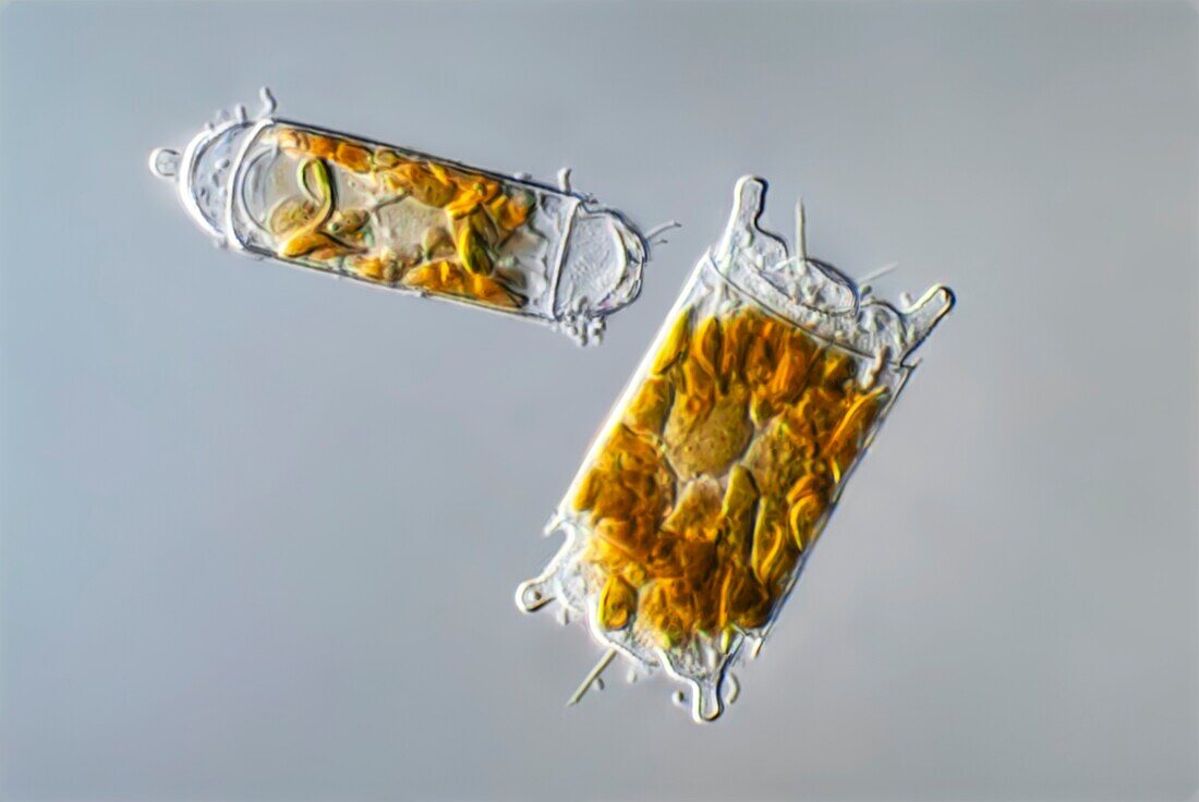 Biddulphia diatoms, light micrograph