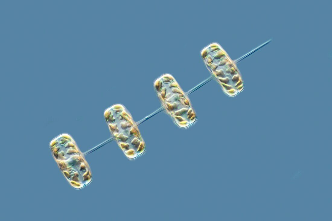 Thalassiosira diatoms, light micrograph