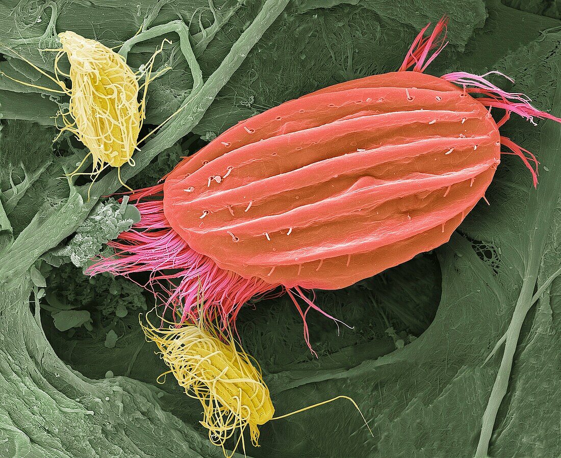 Ciliate protozoa, SEM