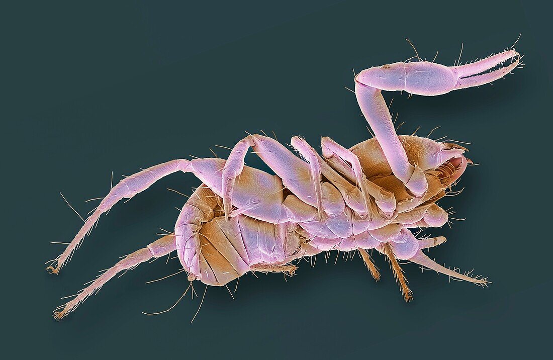 Pseudoscorpion, SEM