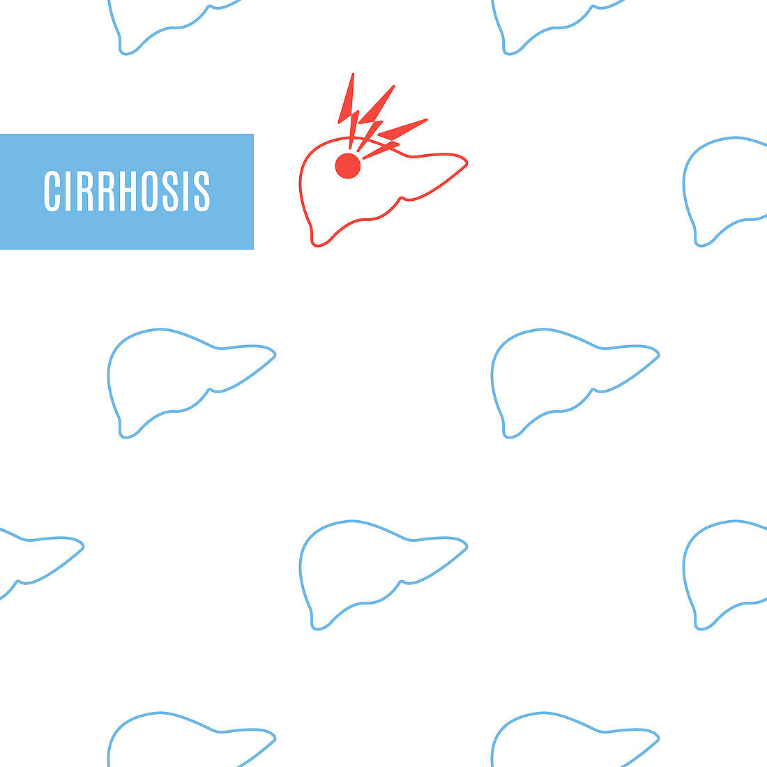 Cirrhosis, conceptual illustration