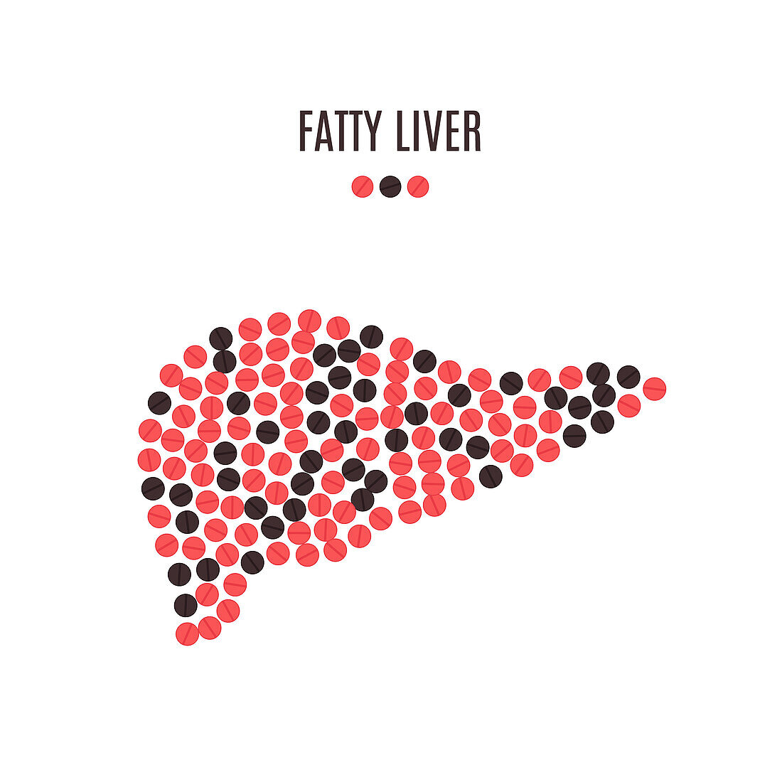 Fatty liver, conceptual illustration